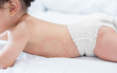 Understanding Baby Skin Sensitivity and Diaper Choices